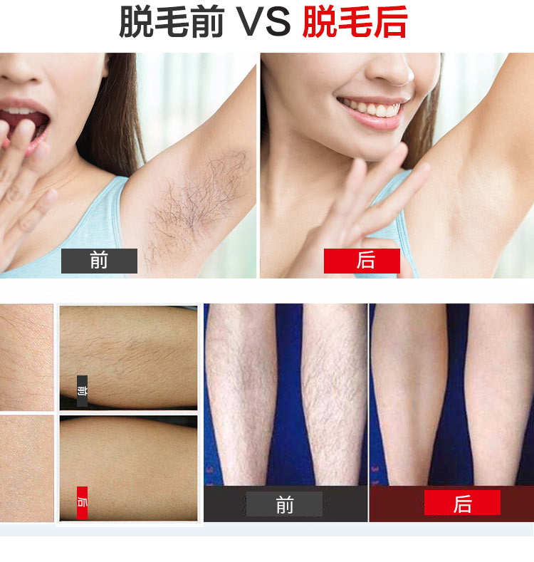 女士禮品脫毛儀 G1便攜小巧精致 光子脫毛儀器 家用禮品OEM貼牌方案 生產(chǎn)廠家(圖9)