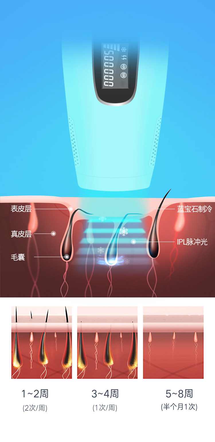 藍寶石冰點脫毛儀 家用女士舒適不痛脫毛儀 脫毛儀廠家(圖8)