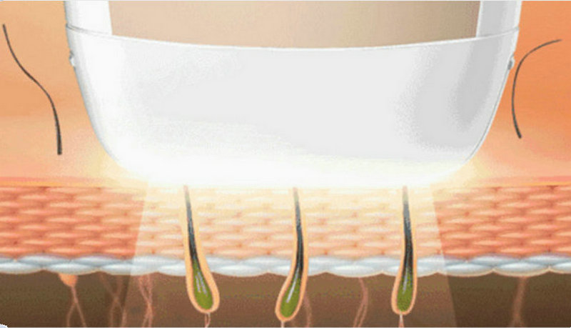 家用脫毛儀，脫毛更簡(jiǎn)單