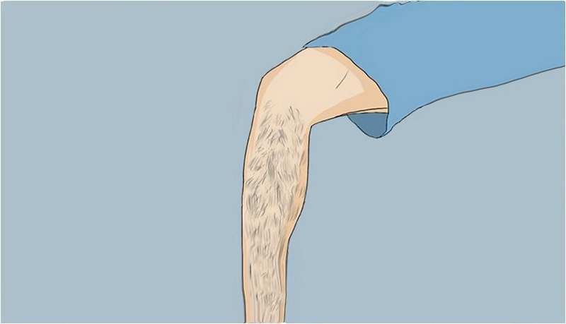 去除毛發(fā)不留根的方法