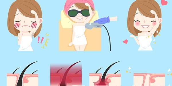 關于IPL光子脫毛的幾大問題(上)(圖3) 家用光子脫毛儀代工生產