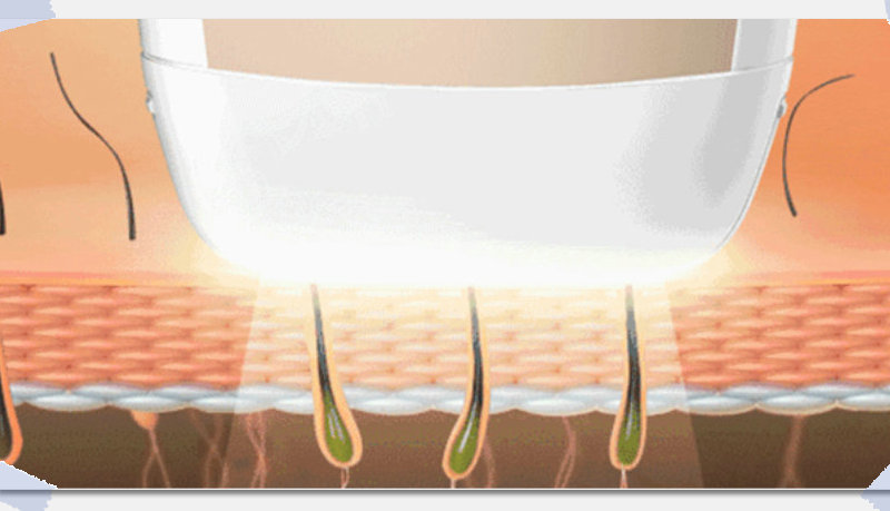 哪款脫毛儀脫毛效果好,看準(zhǔn)這幾點(diǎn)就夠了(圖1) 哪款脫毛儀脫毛效果好,看準(zhǔn)這幾點(diǎn)就夠了(圖1)