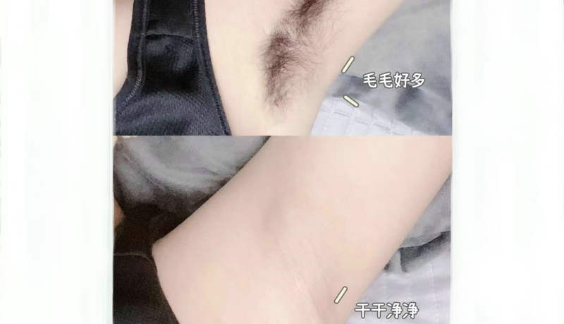 秋天脫毛有什么好處嗎?(圖1) 秋天脫毛有什么好處嗎?(圖1)